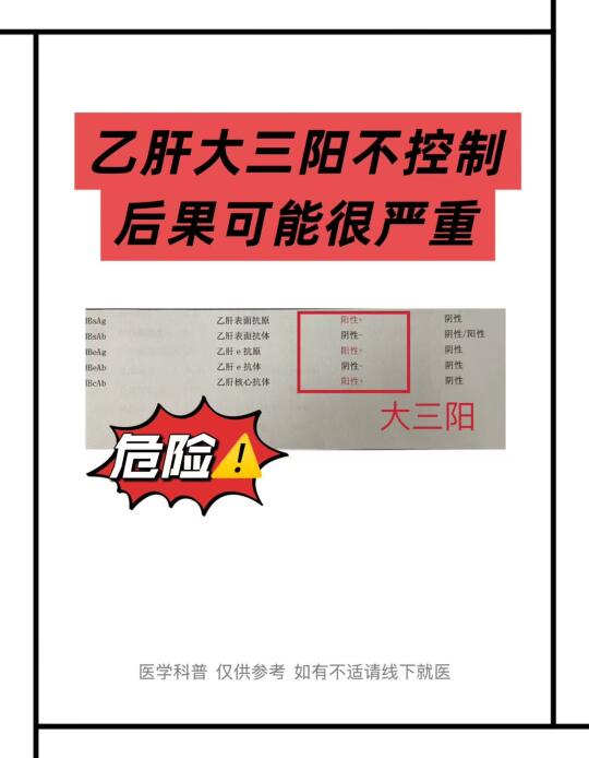 乙肝大三阳不控制，后果可能很严重！