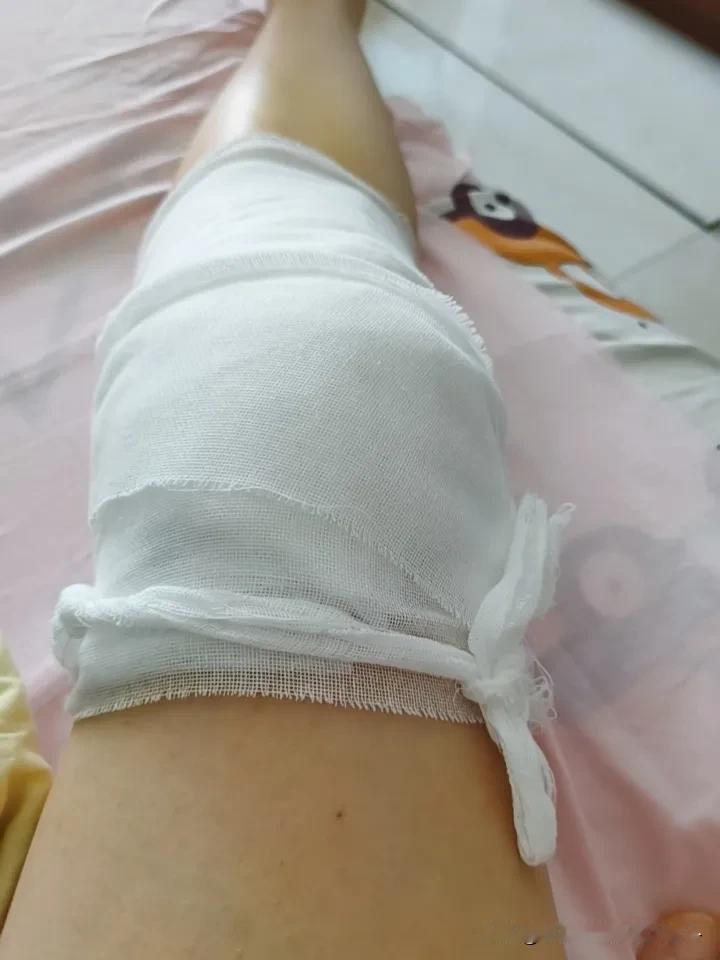 折友们，你们骨折之后都是谁照顾你们？婆家人还是娘家人？子女还是老公？
我出院不到
