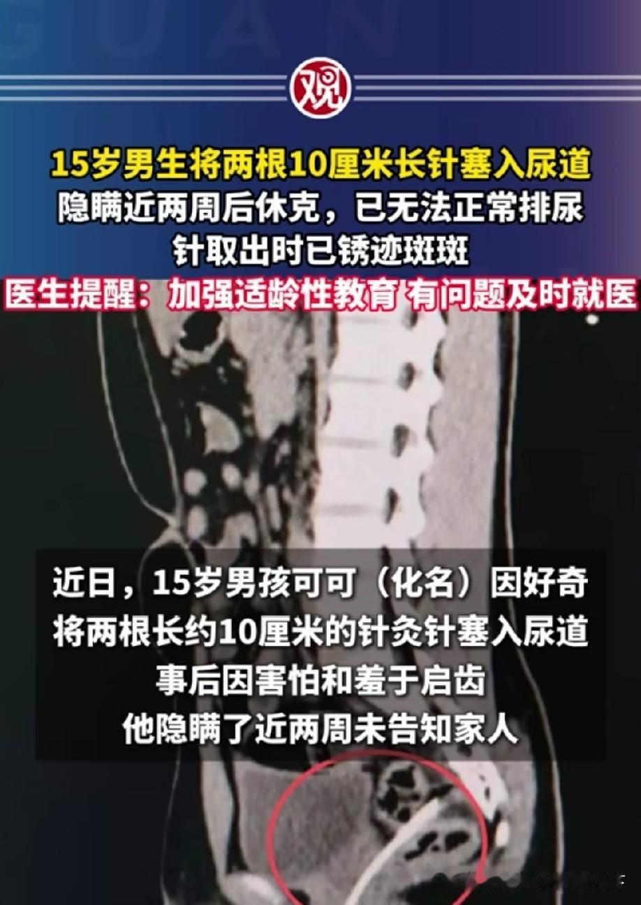 这孩子以后必成大器[赞]毕竟小时候就这么狠，还这么能忍！