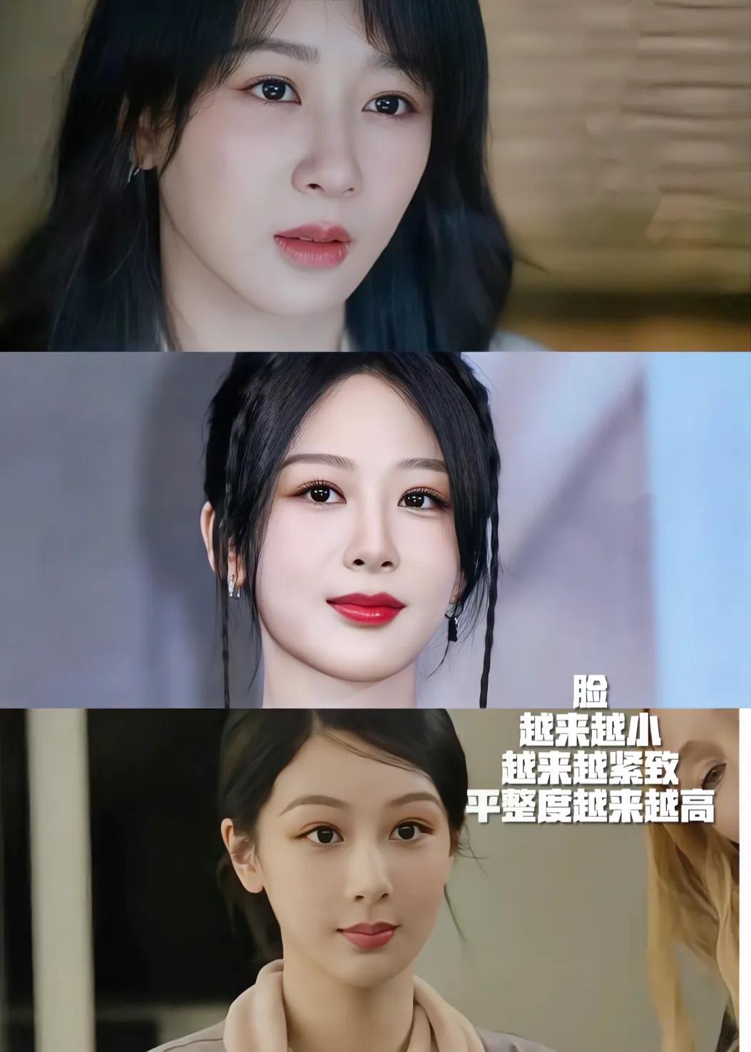 她居然做了加法，并不是面部平整度越高越漂亮，这样反而显假，感觉和金晨同一个医生 