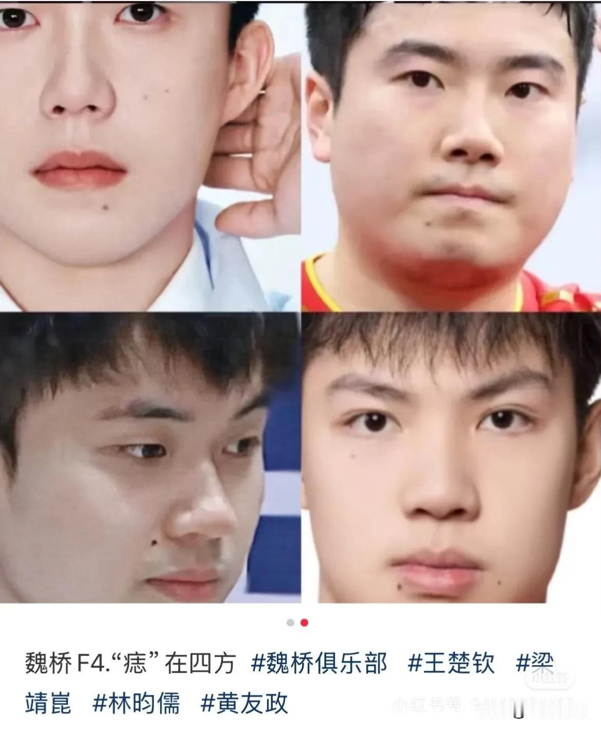 魏桥F4!好男儿“痣”在四方！真的在四方啊[捂脸]这都被发现了！
魏桥只要有痣青