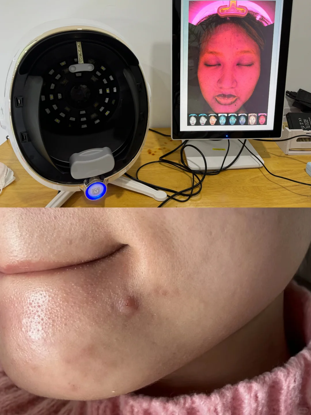 第一次去看闭口差点被骂哭（挂科纯记录）