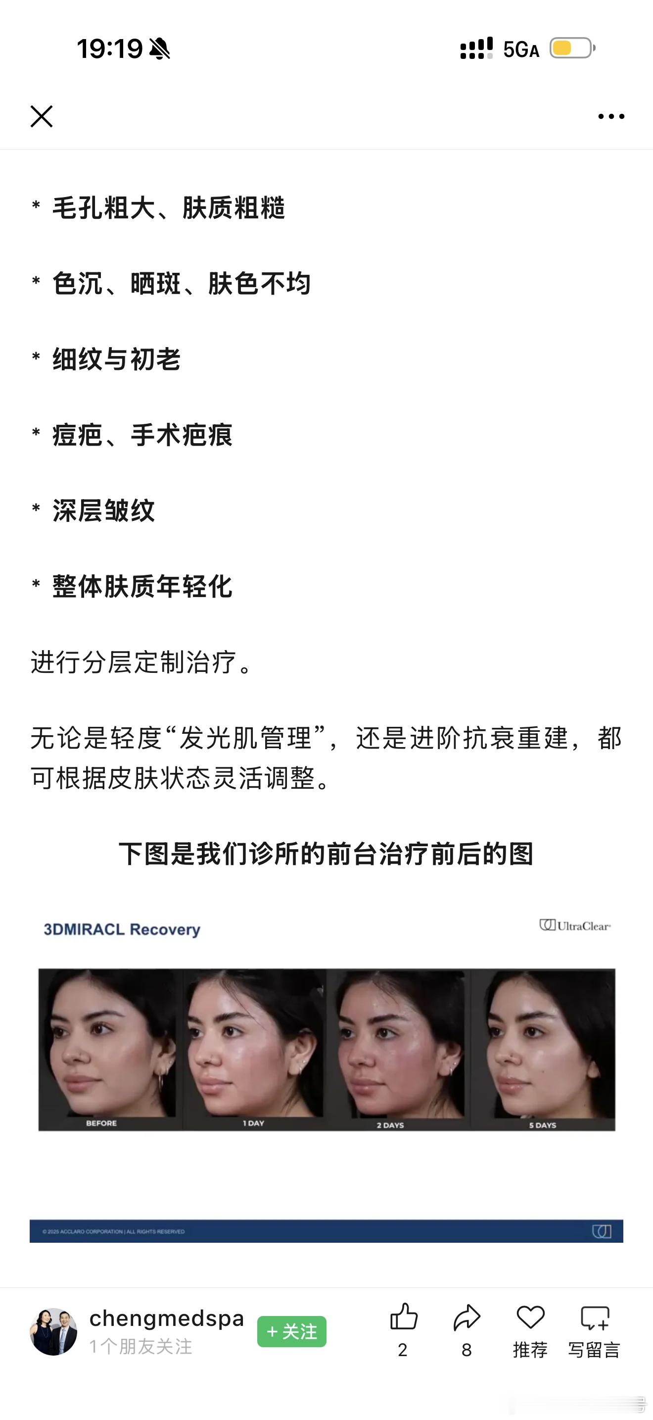 UltraClear这台机子！！下次我去韩国一定要做。是冷剥脱激光，特别适合屏障