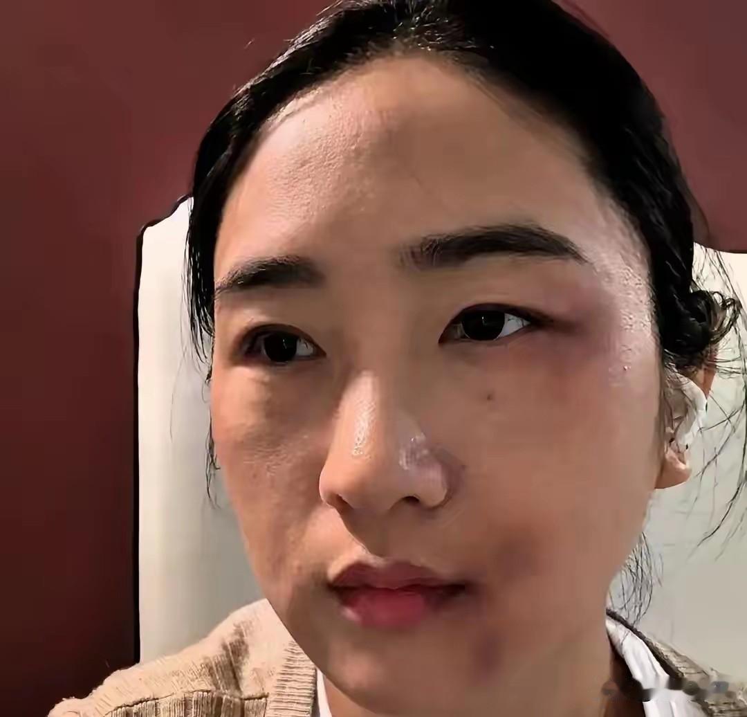 邻居王姐被家暴十几年，前天终于爆发了，她问初中儿子“你爸再打我你帮谁”，儿子头都