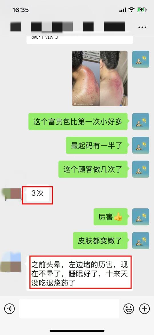 扶阳罐调理反馈来了