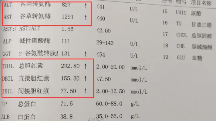 这3项有问题，可能你的肝脏出问题了！ 我们拿到肝功能检查单以后一定要先...