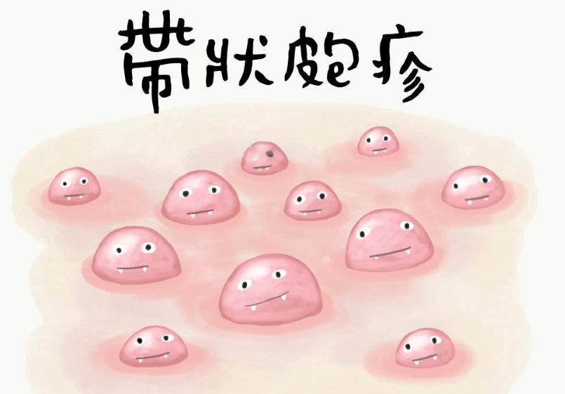 一旦感染终身携带！发作时痛不欲生，超九成人体内潜伏有这种病毒

这种十分折磨人的