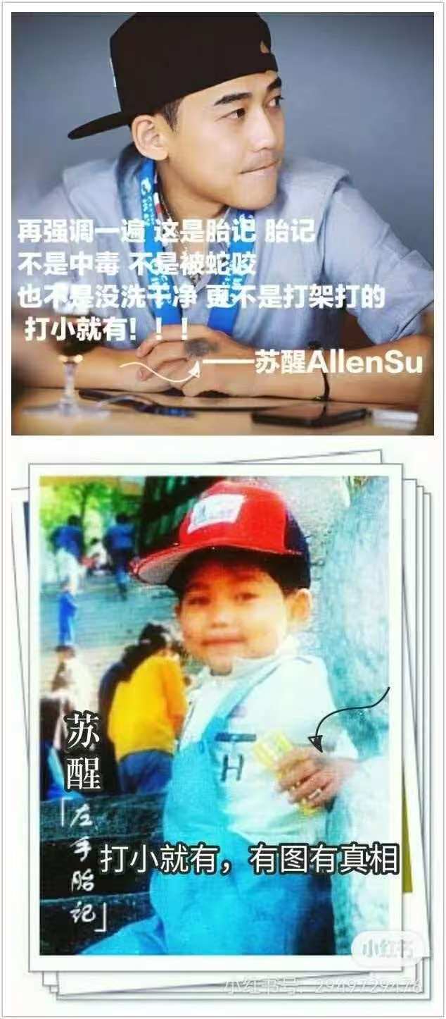 苏醒手怎么了苏醒真是一颦一笑都牵动着大家的心 连手都这么值得关注 没错 我哥哥这