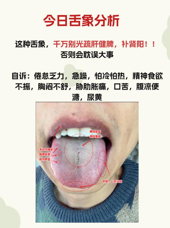 今日舌象分析