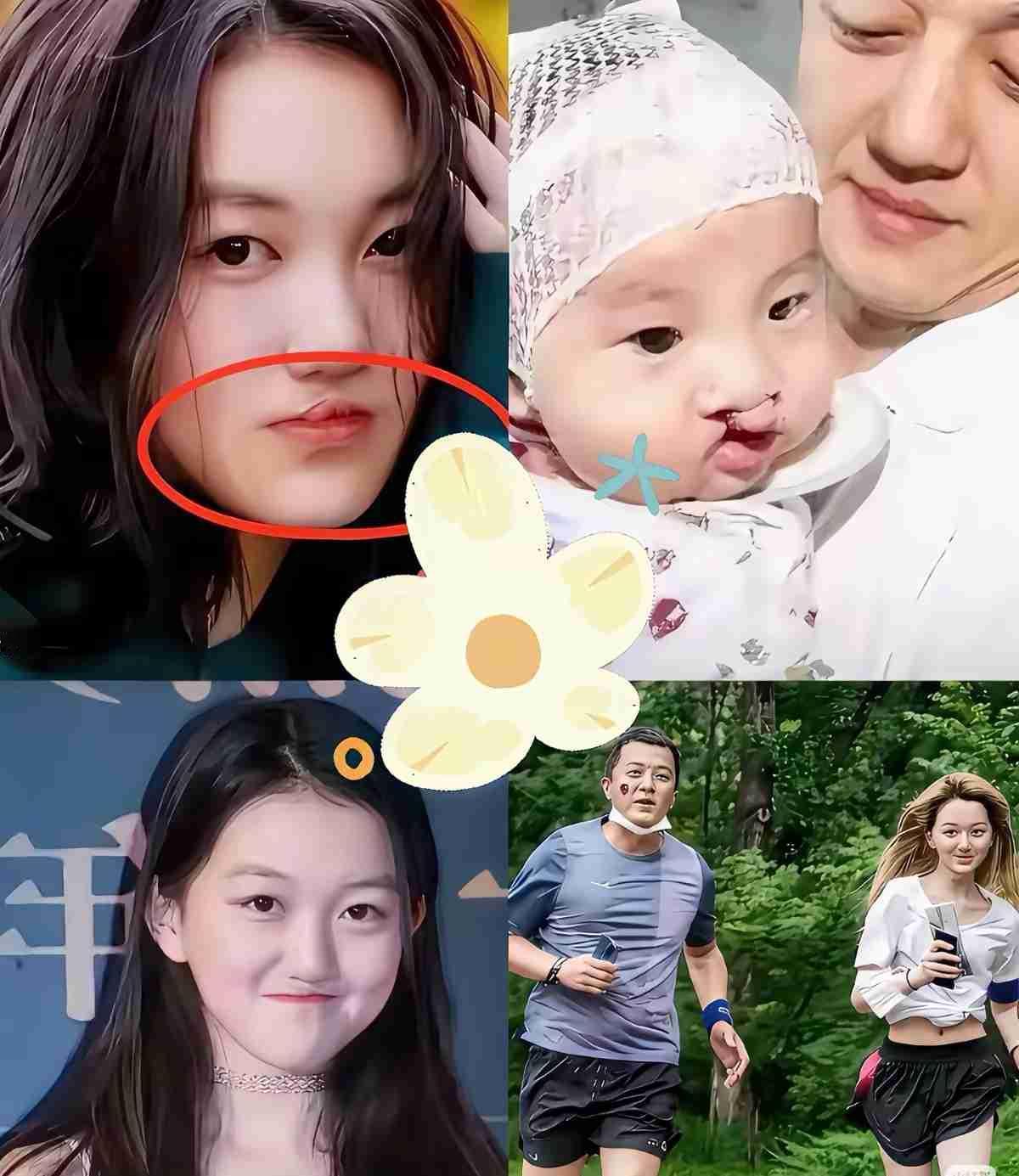 一句话撕开“慈善作秀”的面具，李亚鹏这波操作太戳人
 
朋友总说，那次嫣然慈善晚