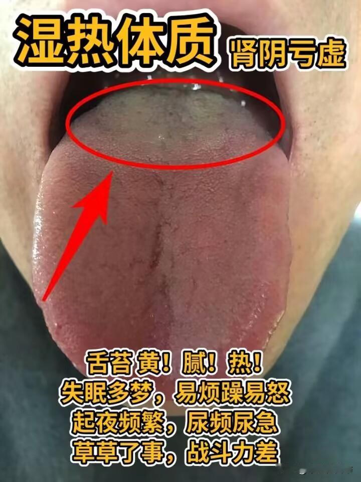 寒湿、湿热、阴虚、肝郁。常见问题舌象大全，快来对照一下
#中医##养生#