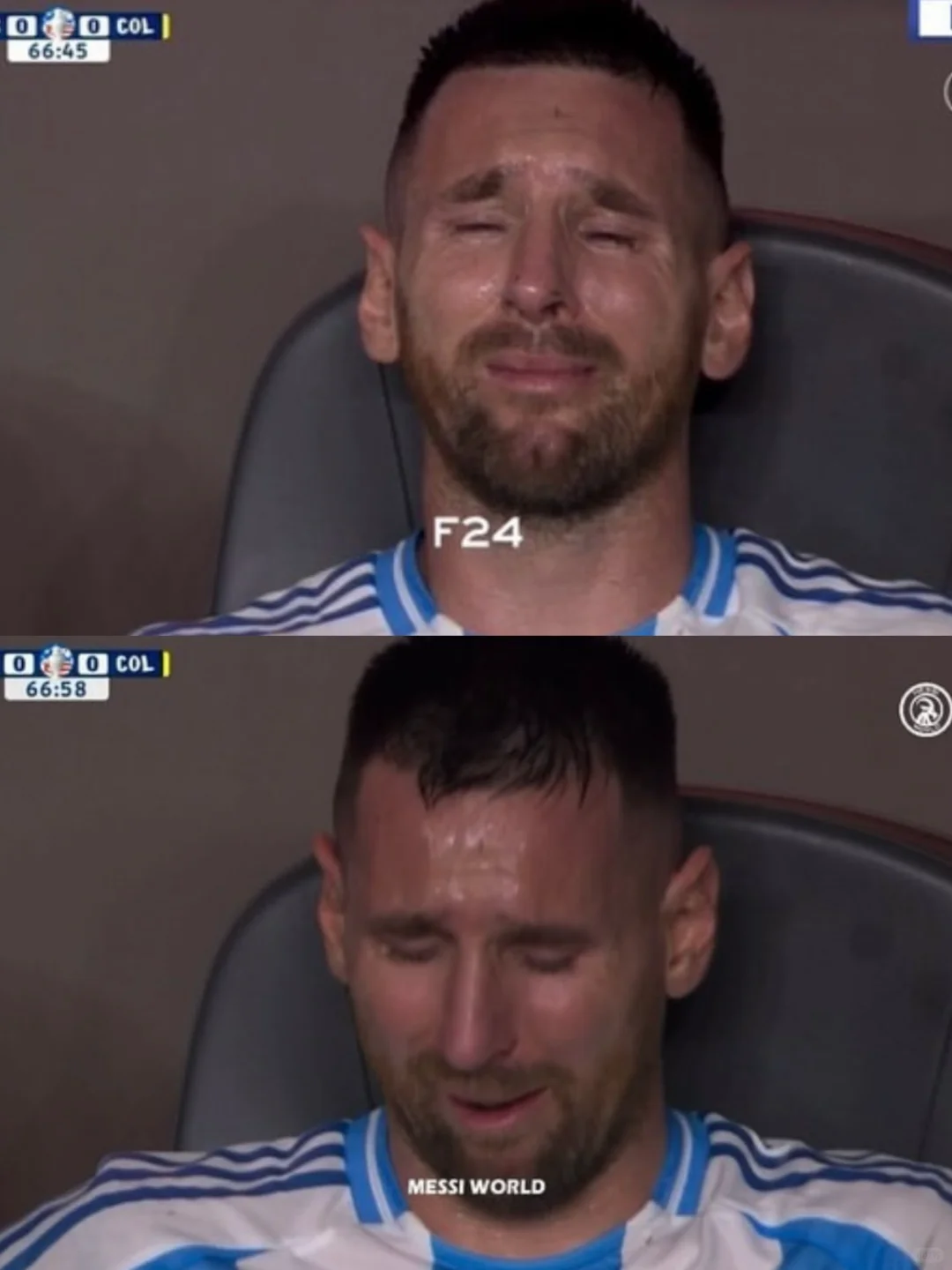梅西受伤离场🥺💔