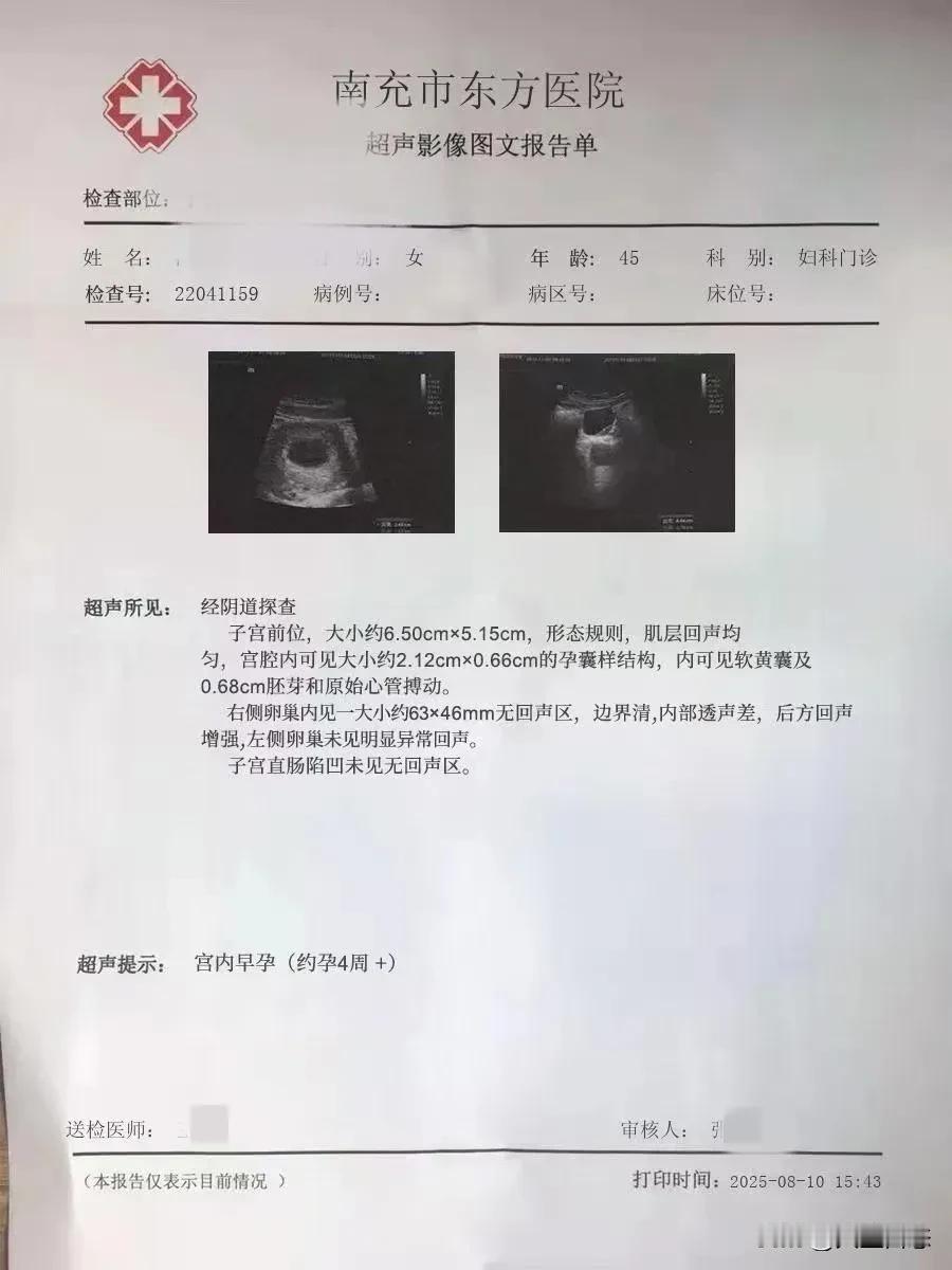 45岁怀孕是“喜”还是“险”？6cm囊肿与4周胎芽同现，医生紧急提醒：
需要谨慎
