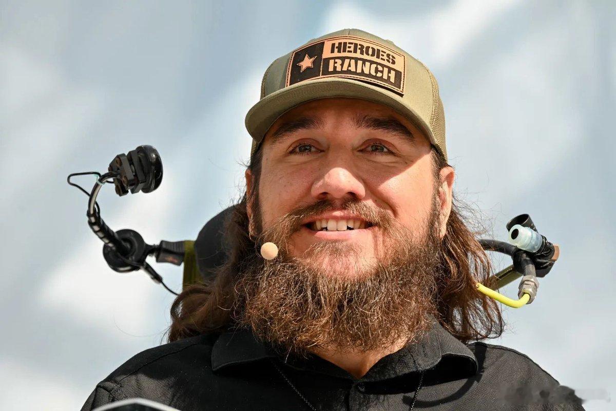 Neuralink（神经连结）患者无需手术即可获得特斯拉式的升级患者 1：诺兰·