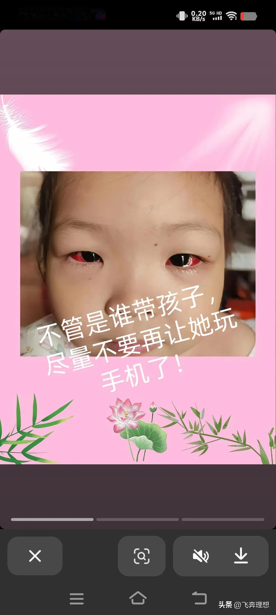 小孩玩手机的悲哀！这个才几岁的小女孩由于大人放纵她成天玩手机，就造成了这样的后果