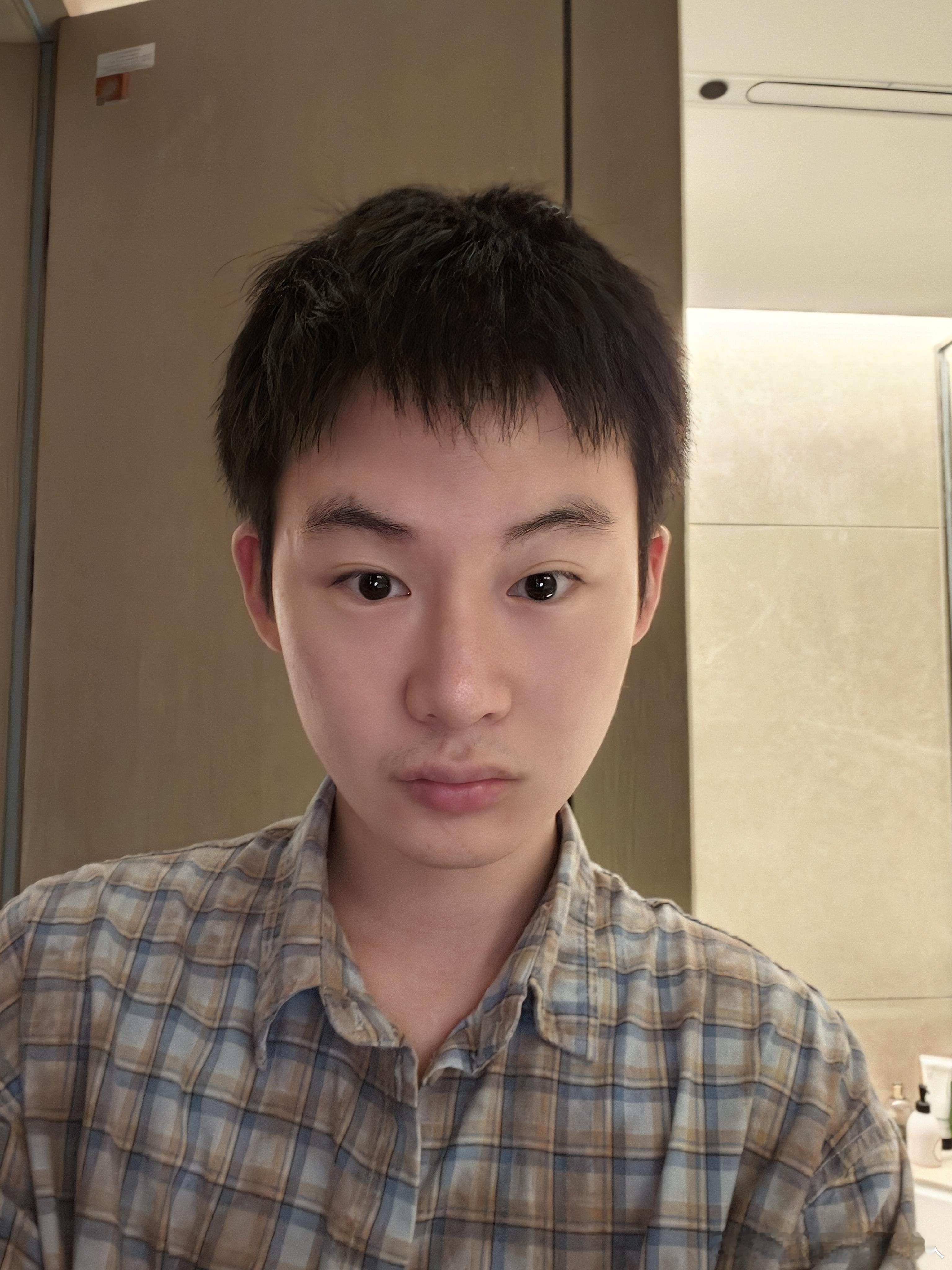 下巴打玻尿酸的地方长了一颗痘