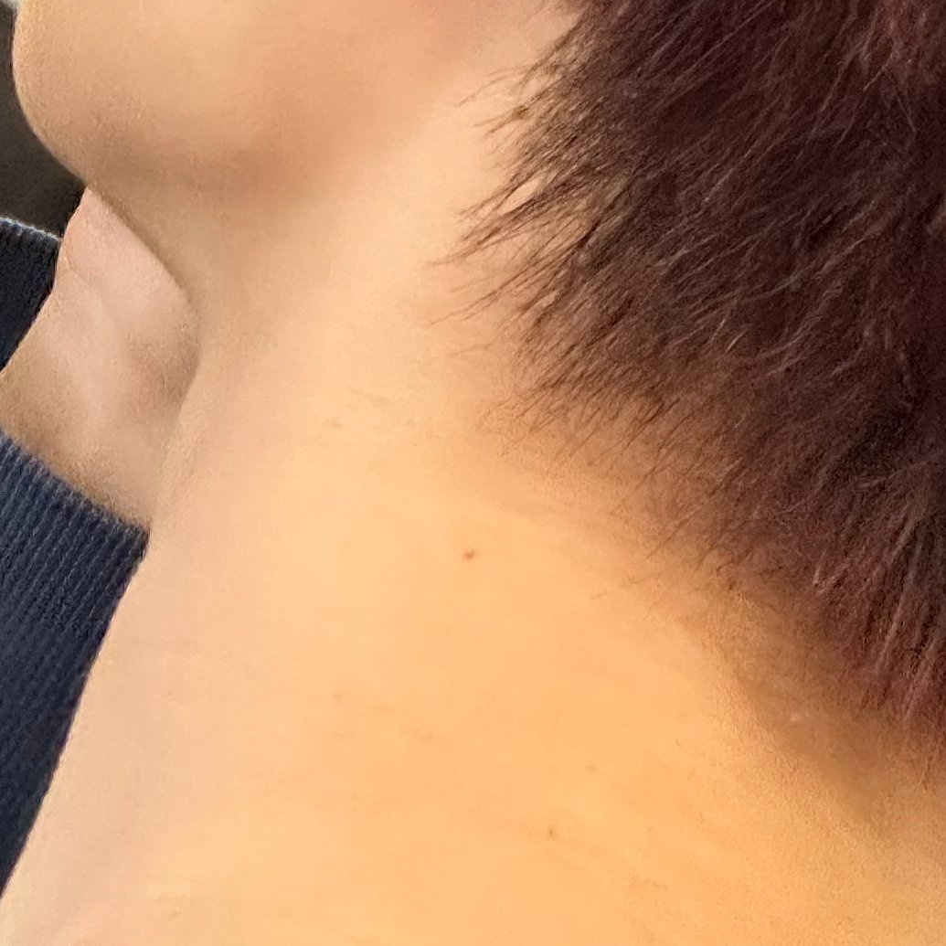 我跟你们讲完全受不了lzx他这个人有点说法的脸上有痣耳朵上有痣脖子上有痣手臂外侧