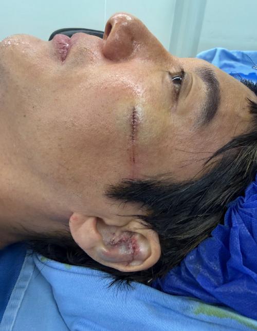 王力宏带伤唱完全场，现在网络上的声音，清一色都是在夸他敬业，可仔细想想这事，它压