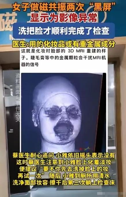 解释不清了！福建一29岁女生头晕，去医院做头颅磁共振。不料，连续2次扫描，都因面