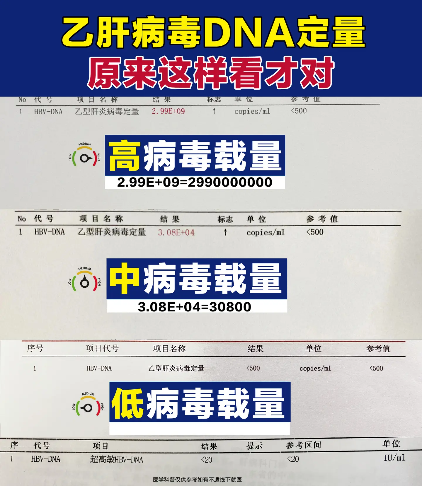 1.高病毒载量：≥6次方以上，说明病毒复制活跃，传染性强，若伴随肝功能...
