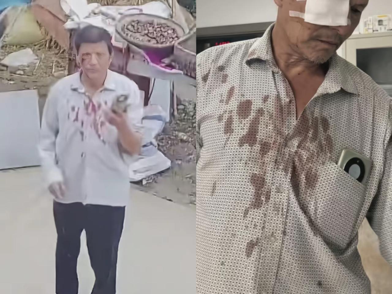 64岁单身大哥晒谷时，见三弟家的鸡啄谷便上前驱赶，竟引来了三弟夫妇的联手殴打，打