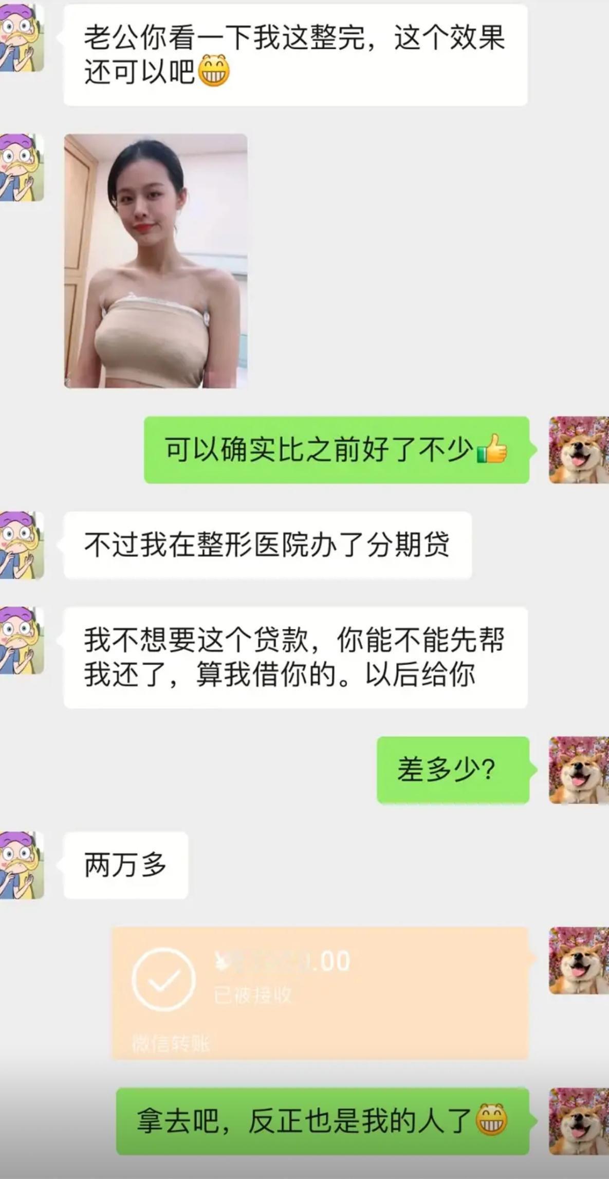 女生做完整形，兴冲冲拍照片发给老公展示效果，得到夸奖之后，才坦白自己办了整形分期