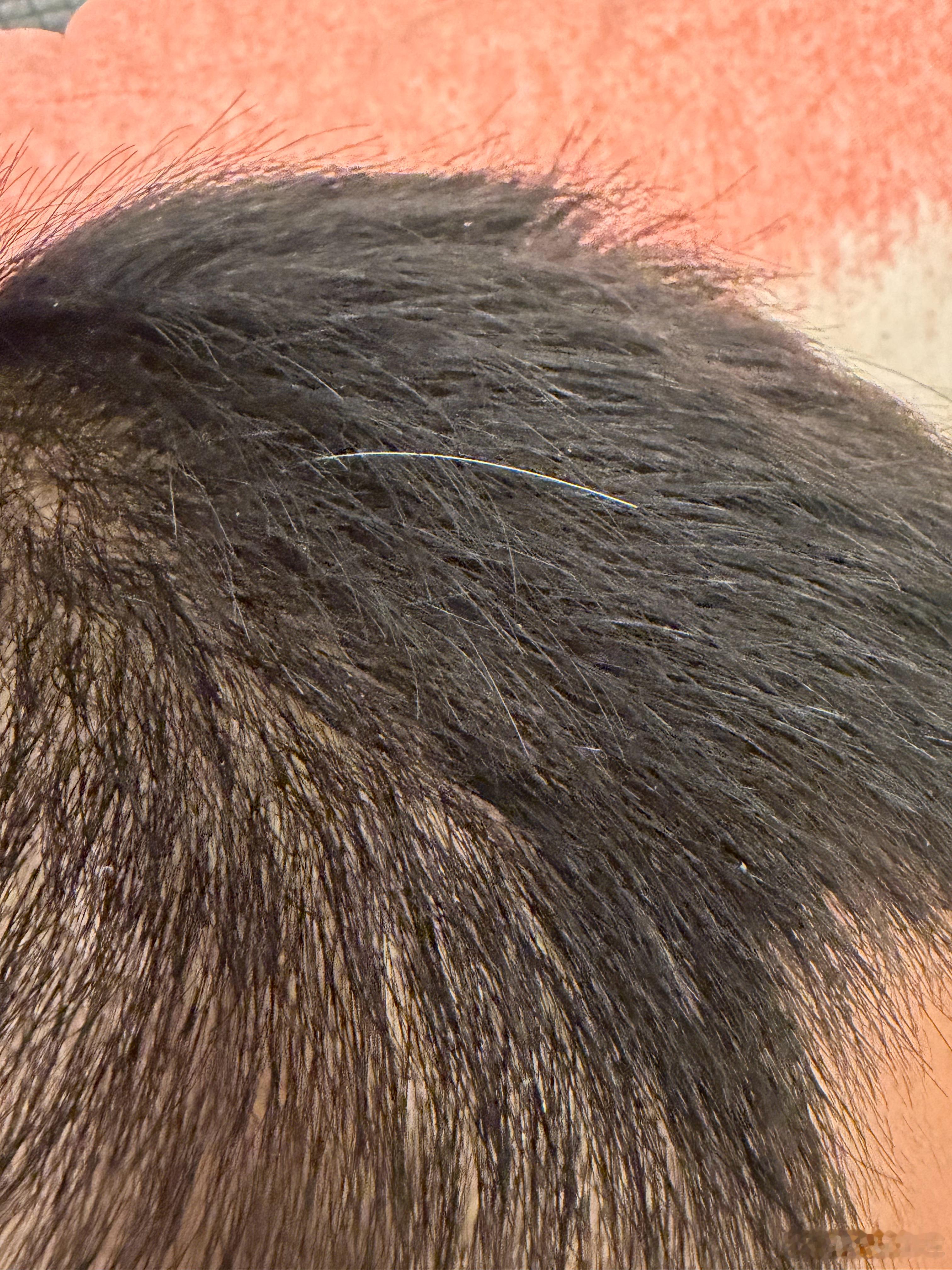 我怎么有一根白头发我的青春期已经过去了吗 