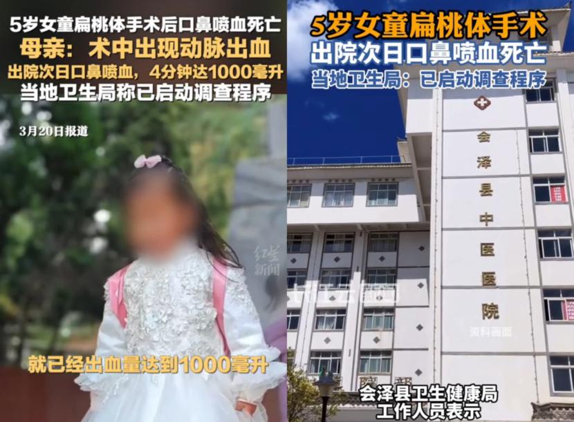 可别被带偏了！
云南5岁女孩离世，
根本不是

网传的扁桃体术后吃馄饨皮的原因，