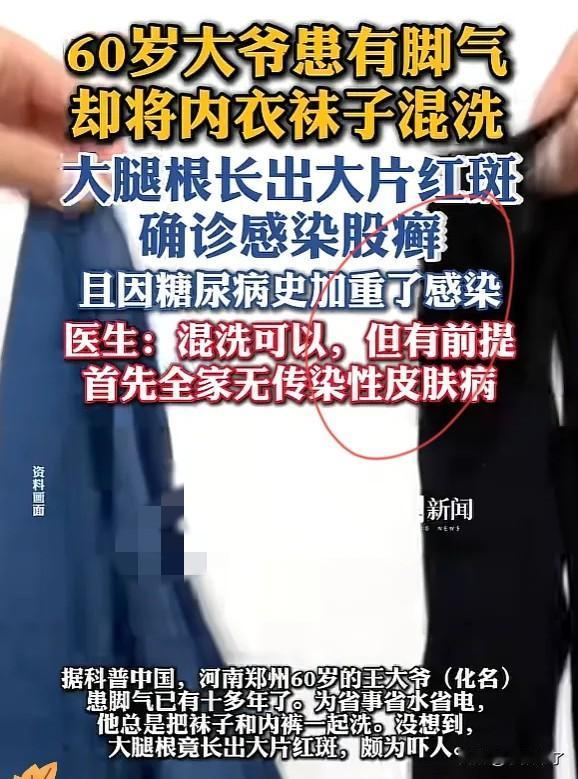 河南郑州大爷的一个洗衣习惯，竟让自己差点栽大跟头，有脚气还混洗内衣袜子，大腿根长
