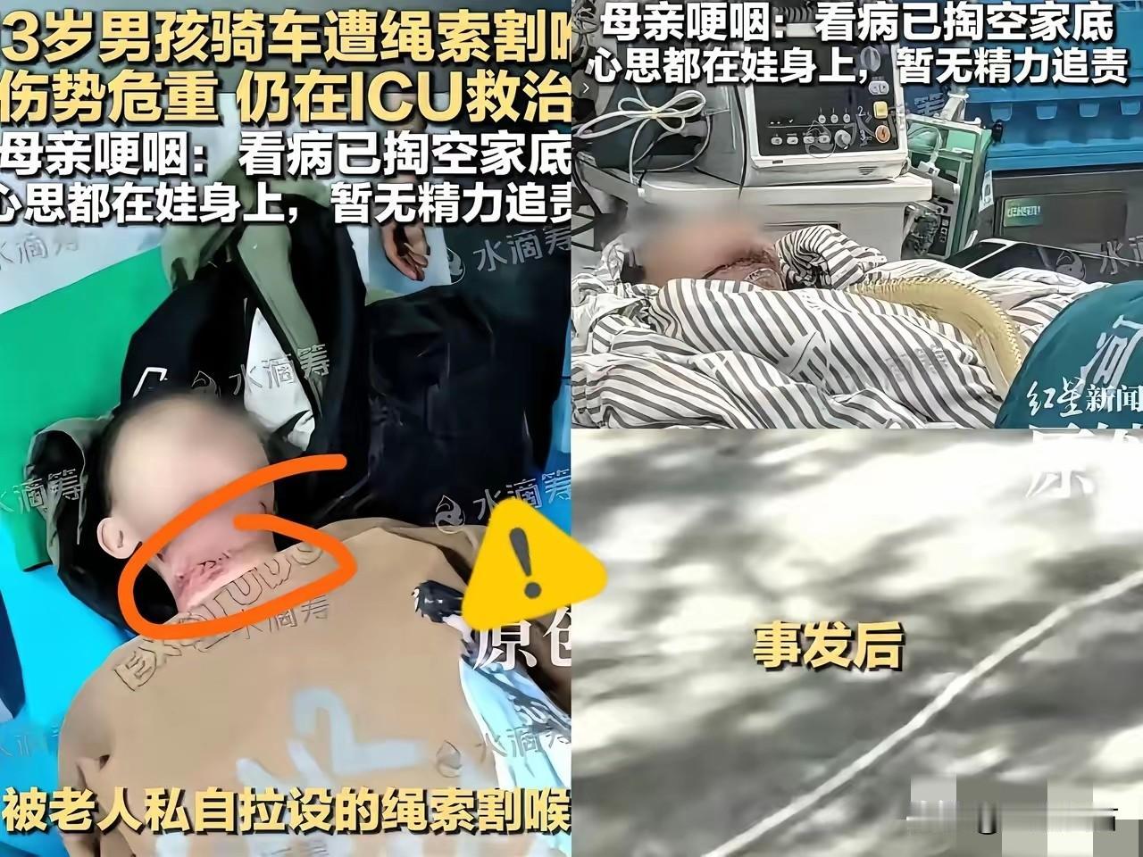 我记得我小时也被绳子勒住过，我是转身拿东西，结果一下子把我弄的人仰马翻！但是我那