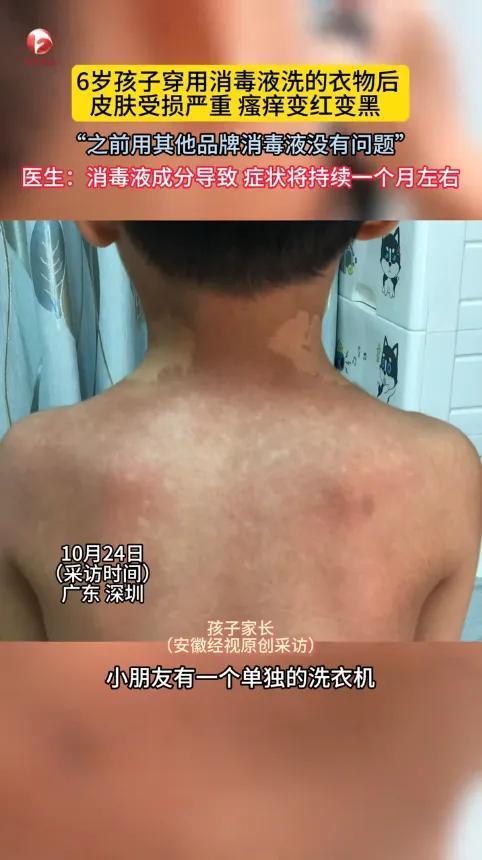 “悲剧还是发生了！”
近日，广东深圳，一家长用洗衣机给儿子洗衣服时，特地加了1瓶