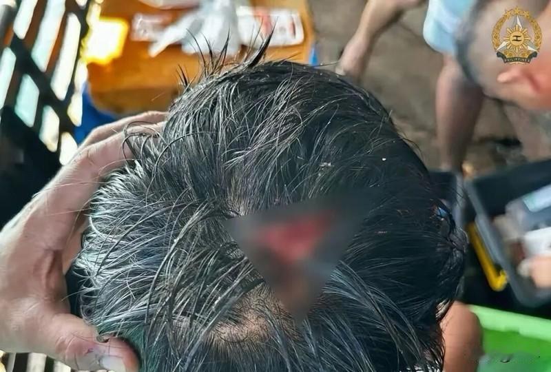 菲防长：只要我们的士兵少一根头发就开战，现在一个开瓢了！！咋办

菲律宾以前把话