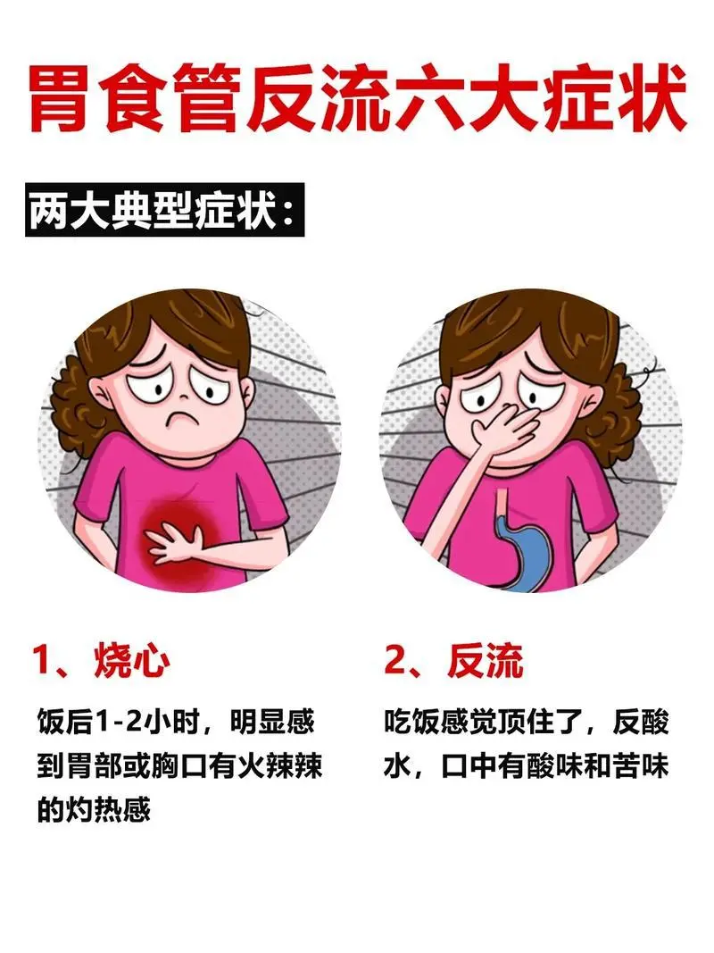 胃食管反流这些症状要注意了！