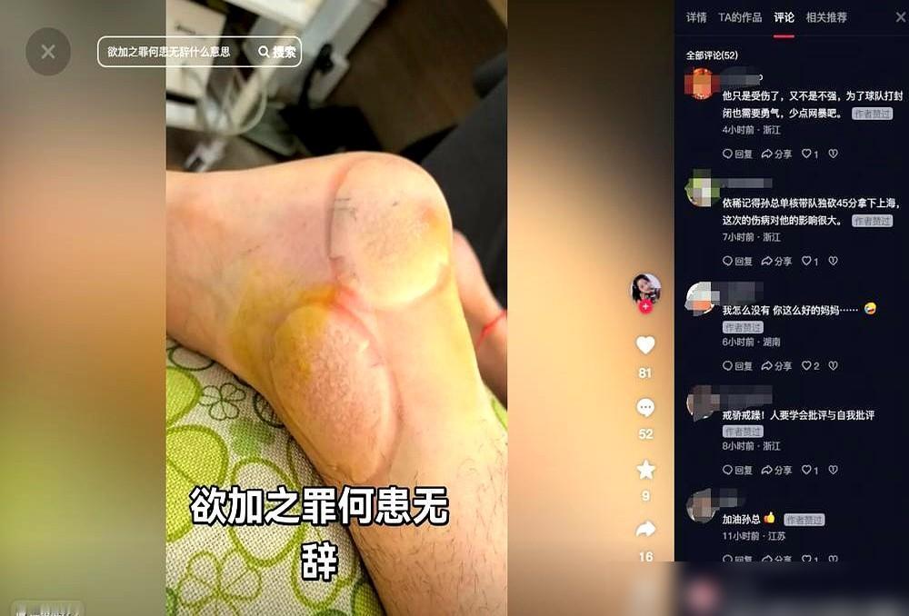 总决赛3场只拿9分，投篮命中率19.4%，他到底在干什么？

说真的换谁带着双脚