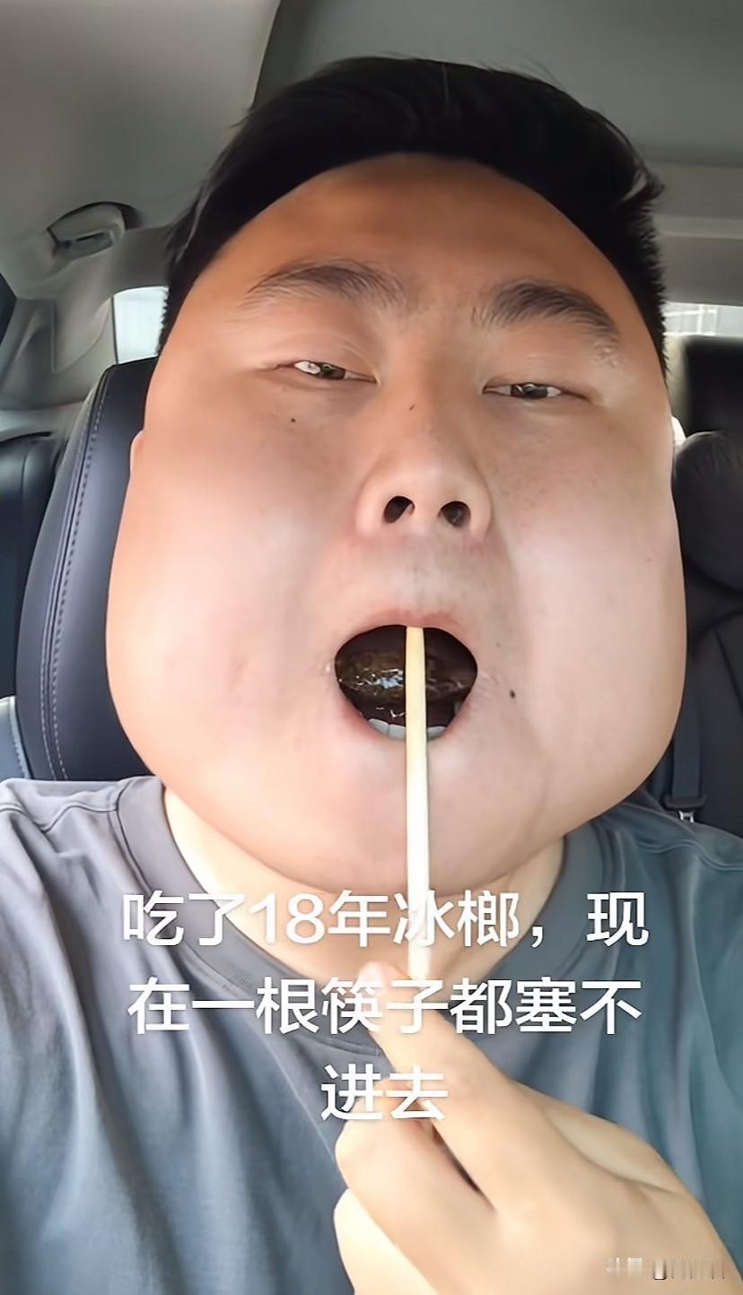 太吓人了，这可不是特效，是真实的方块脸。湖北一男子，吃了18年的槟郎，因为长期咀