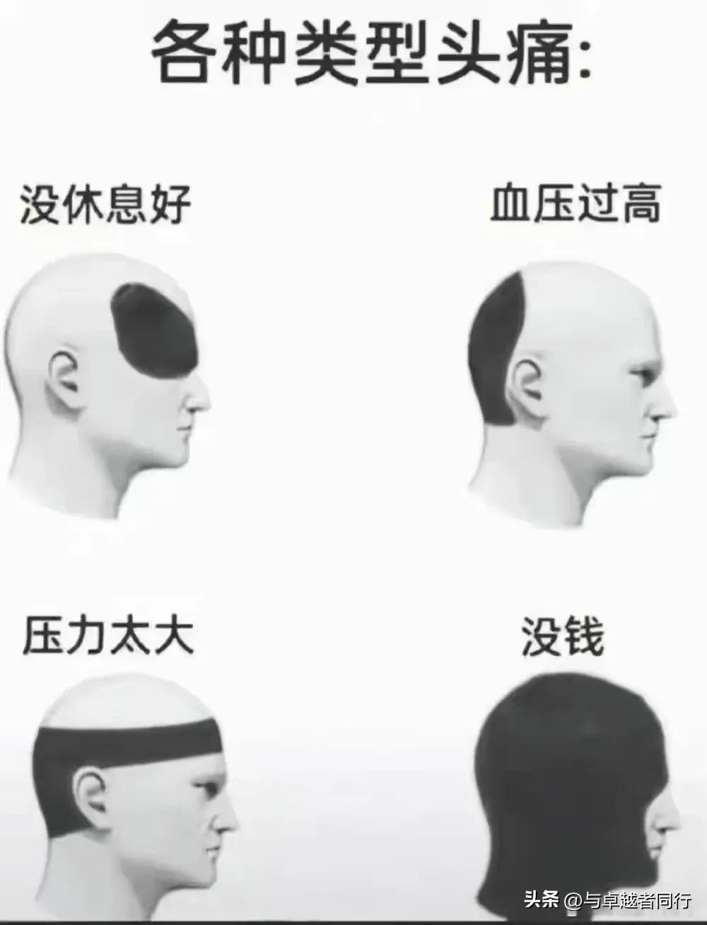 “要准确的判断你们的头疼来源！”