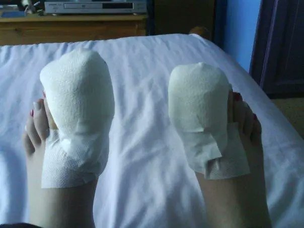 2018年，《神奇动物》剧组一位化妆师不幸罹患脑膜炎和败血症，因血液循环障碍最终