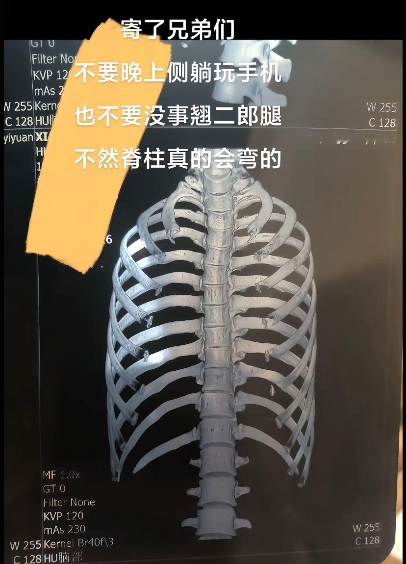 千万不要侧躺玩手机  屏幕前的各位突然坐好是没用的
