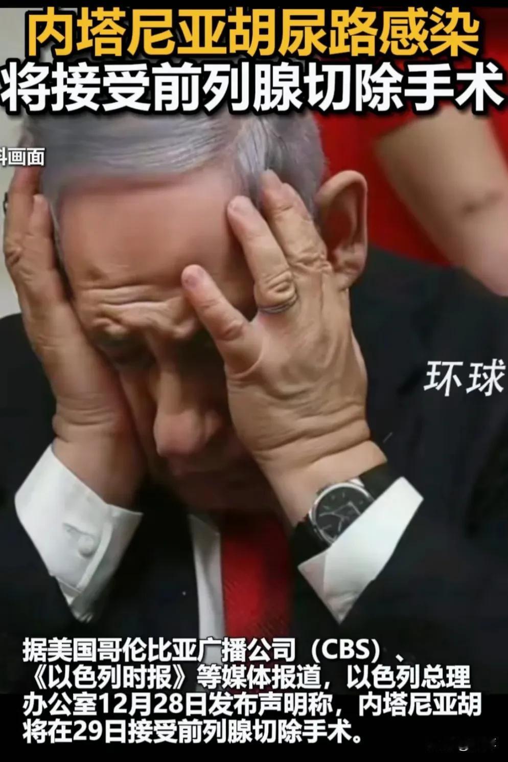 以色列总理内塔尼亚胡因尿路感染，要切除前列腺。不知道他手术后还能不能继续工作？毕
