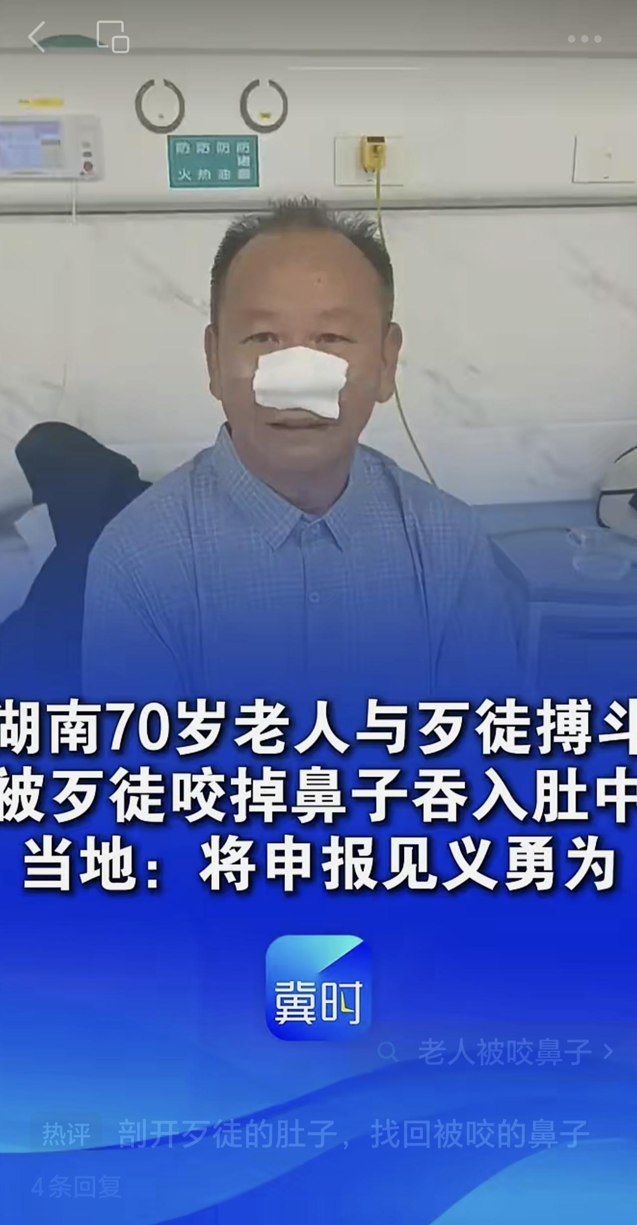 湖南70岁老人与歹徒搏斗，被歹徒咬掉鼻子吞入肚中，当事人：最初没感觉，后来疼到差