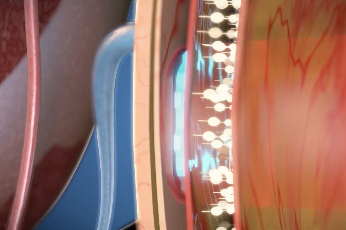 脑机公司Science Corp融资2.3亿美元，估值达到12.5亿美元3月5日