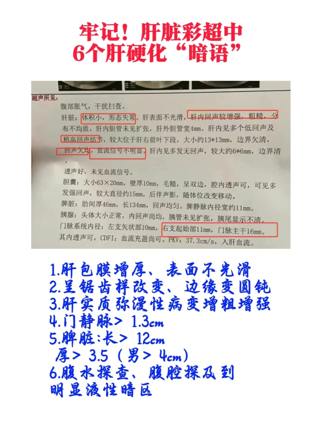 牢记！肝脏彩超中的6个肝硬化暗语！
