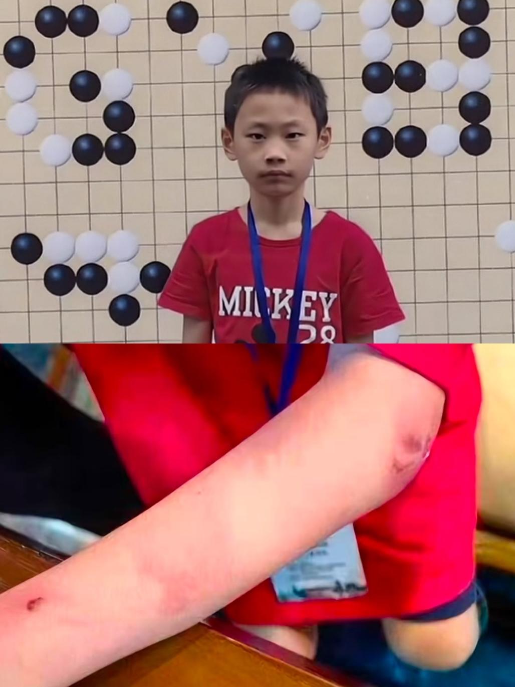 9岁围棋天才只是输了一盘棋，却遭到父亲的拳打脚踢，最后跳楼了。

明明眼里该是无