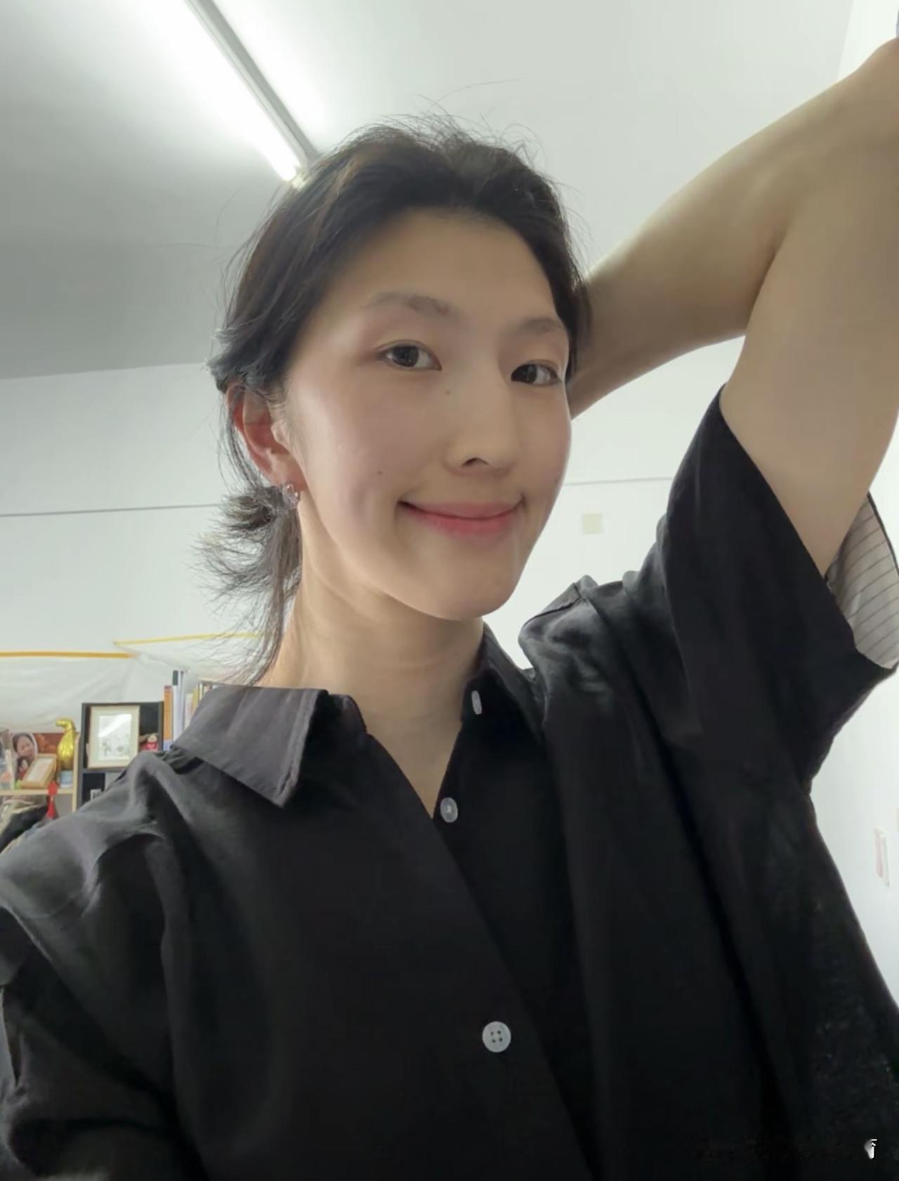 吴梦洁剪短头发了！乍一看跟江苏女排的副攻手杨佳很像！吴梦洁的手术看起来不严重啊，