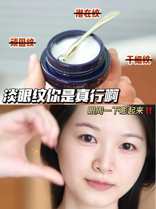 眼纹消失术，上了A醇眼霜的车直接原地赢麻