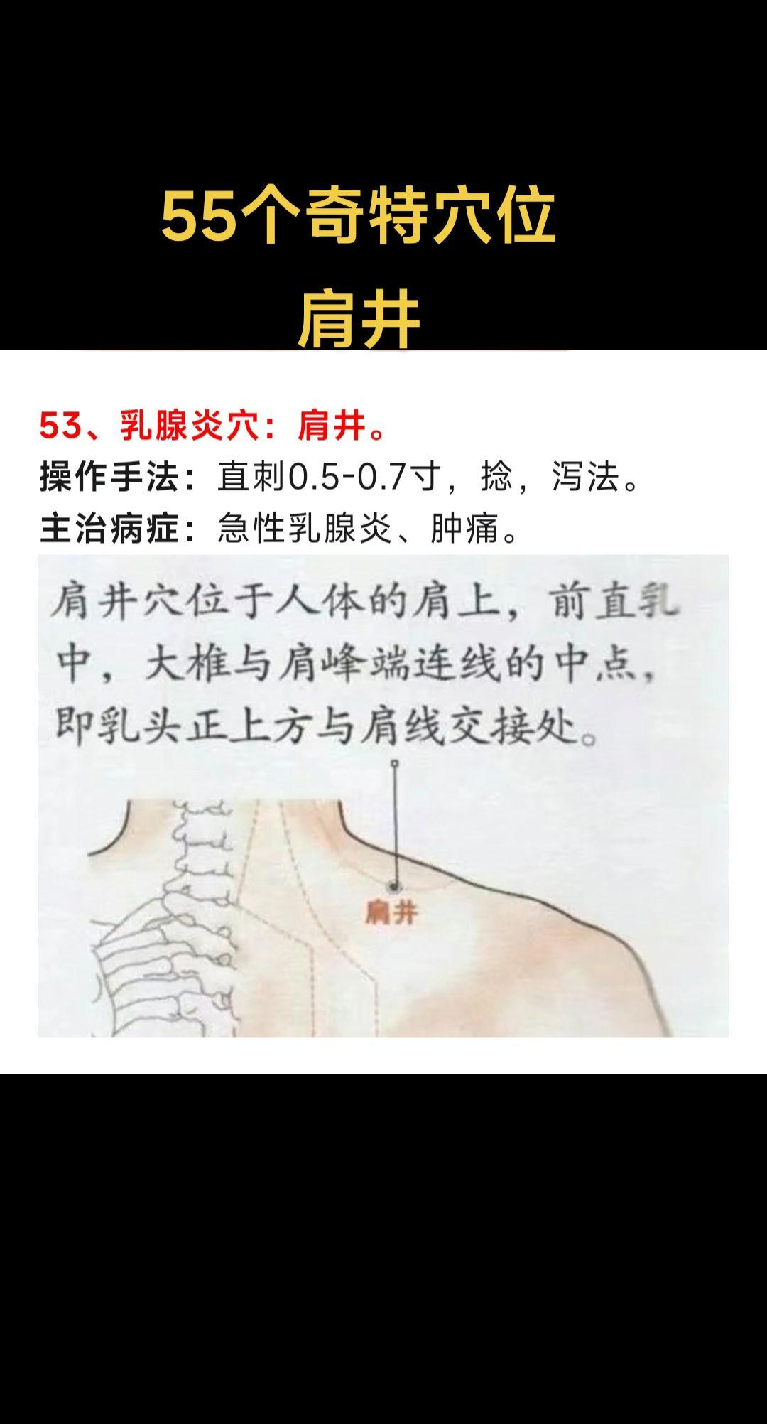 肩井