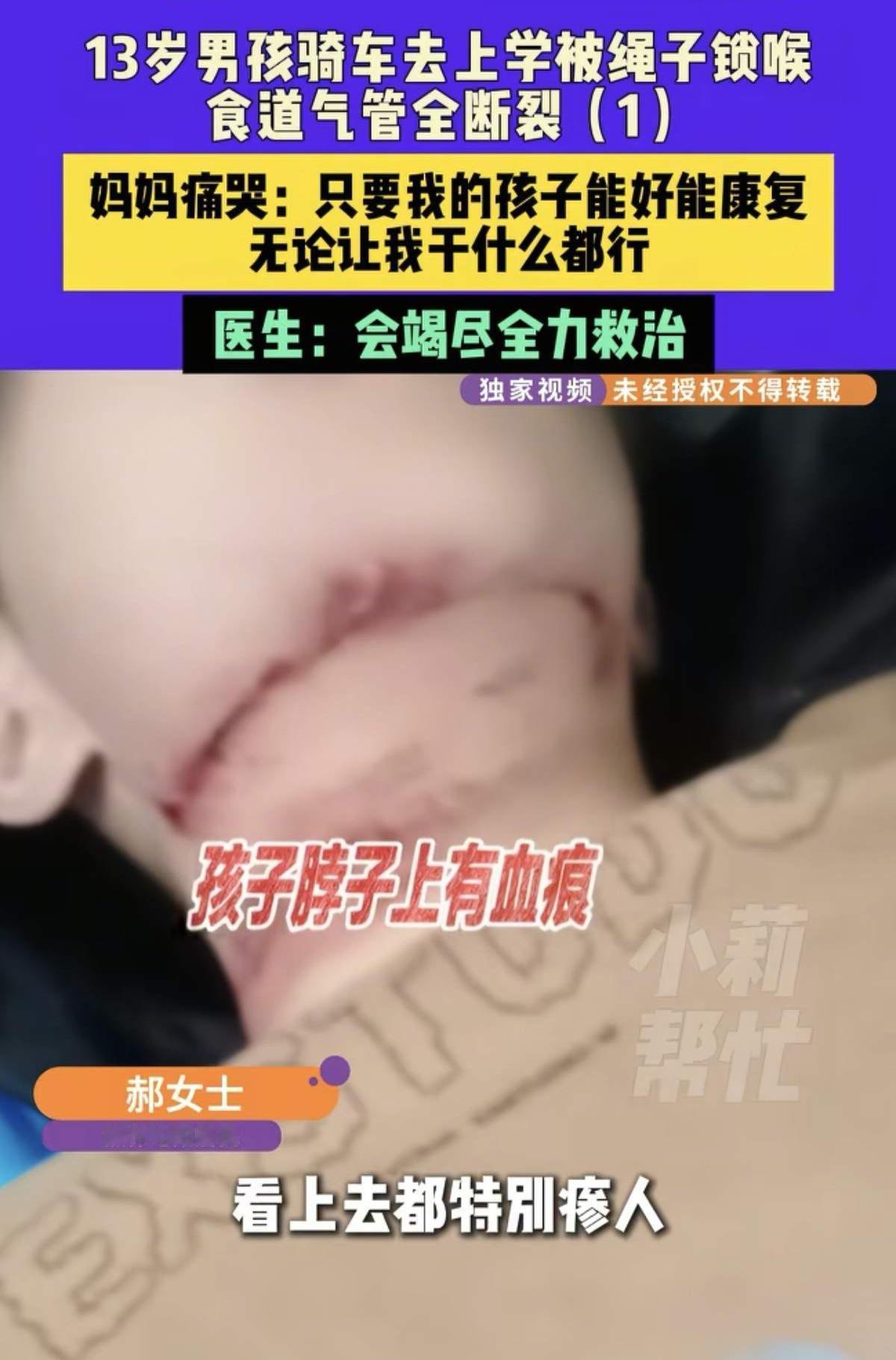 看了河南焦作13岁男孩被绳子勒喉，我立马做了这3个决定：

第1.骑车的时候要戴