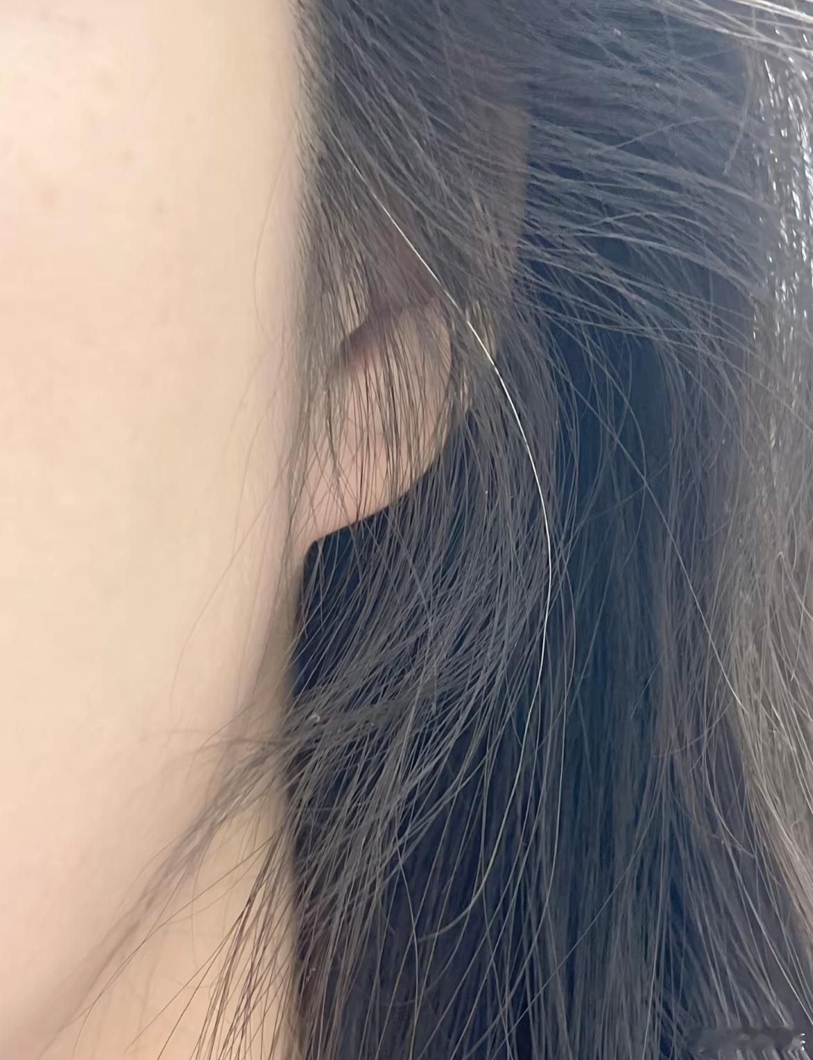 一根白发会影响颜值吗？要不要拔掉！ 