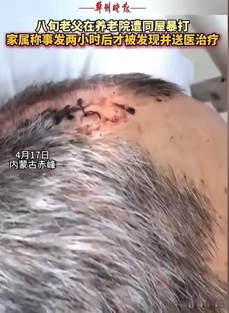 内蒙古赤峰，女子将丈夫送到养老院，几天后接丈夫，只见丈夫裤子直接裂开到裤裆，上衣