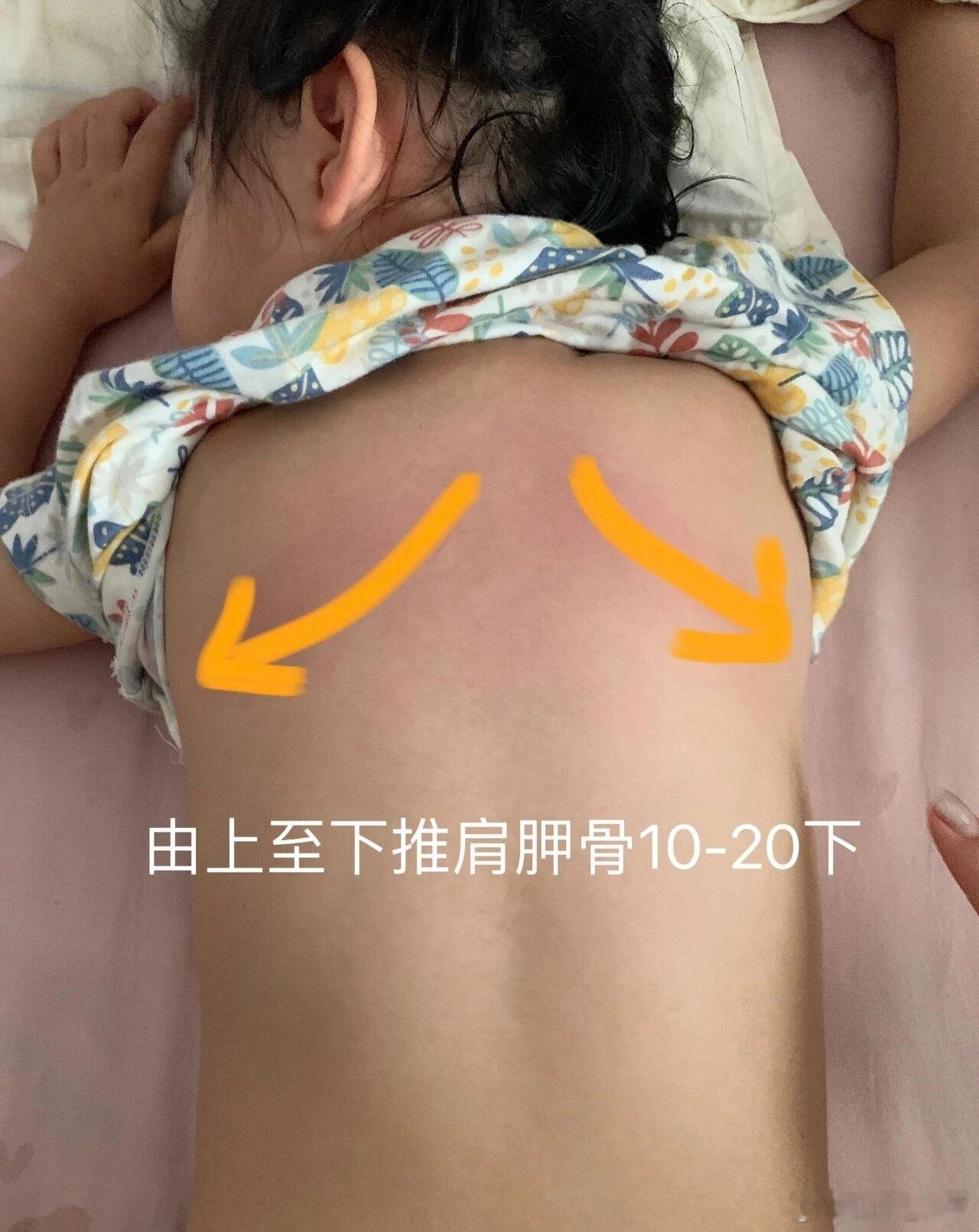 小儿推拿的小细节最常用的: 1.捏脊，向上⬆️补阳，适合白天；向下⬇️安神，适合